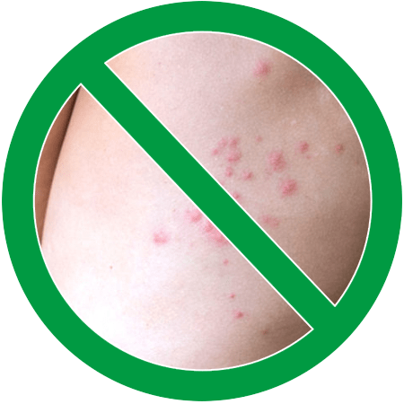Image of bed bug bites on human skin in green circle slash icon; Northern Pest safely and effectively treats your home or business for bed bugs.